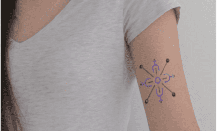 This Tattoo Changes Colors As Your Blood Sugar Levels Change